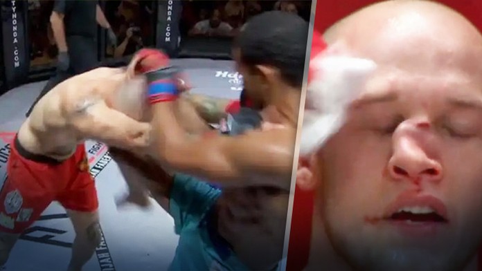 Po zásahu kolenom mal jeho nos tvar písmena “C“. MMA bojovník prosil rozhodcu, aby ho nechal pokračovať