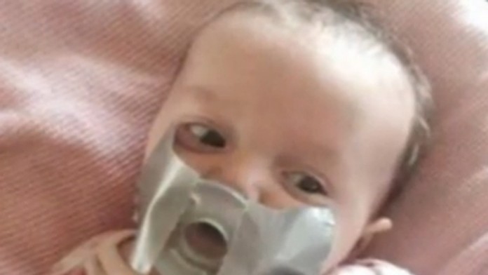 Bábätko má cumlík prelepený lepiacou páskou