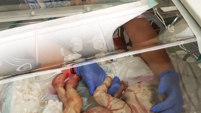 Harper po narodení. 