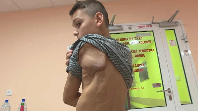 Lukáš si prežil viac bolesti ako ktorýkoľvek dospelý