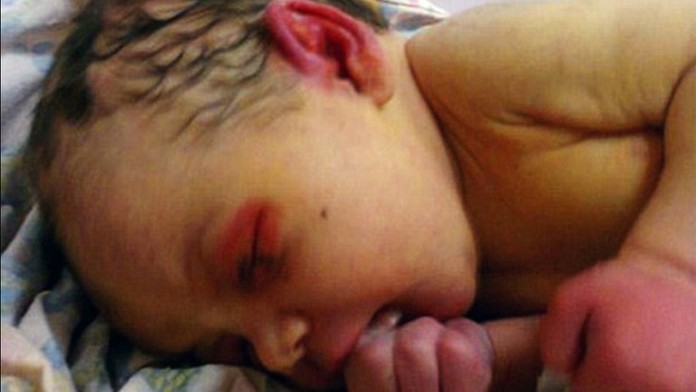 Dievčatko našli opustené v lese. Objedali ho mravce.