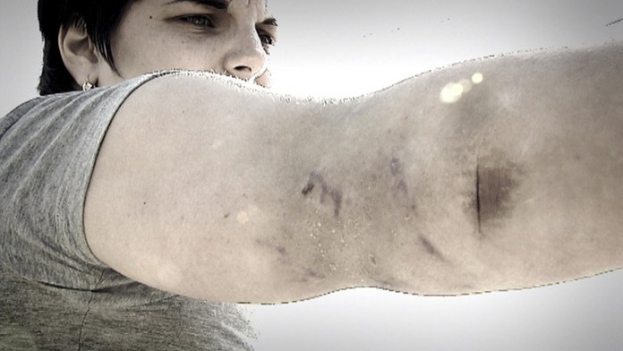 Ženu dohrýzol pes.