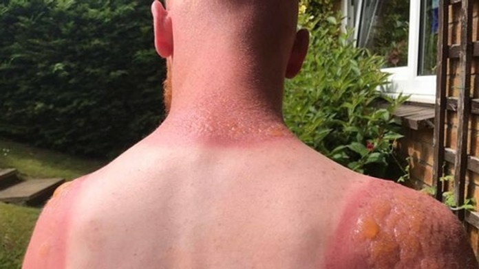 V Škótsku tak horúco obvykle nebýva.