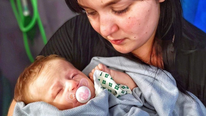 Malá Lilien sa narodila so zriedkavým ochorením.