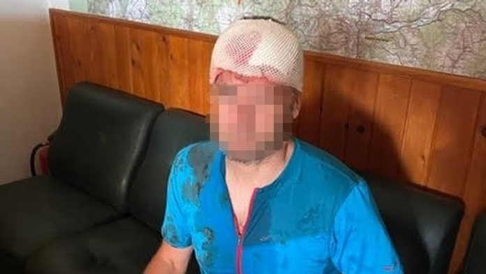 Medveď zaútočil na horského záchranára na turistickom chodníku z Novej hole