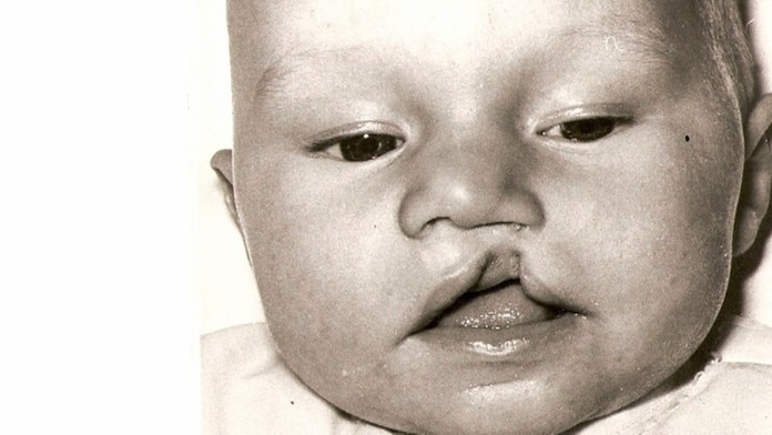 Deti zomierali a rodili sa postihnuté.