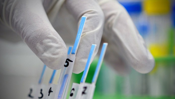 Drsná bitka v Calais