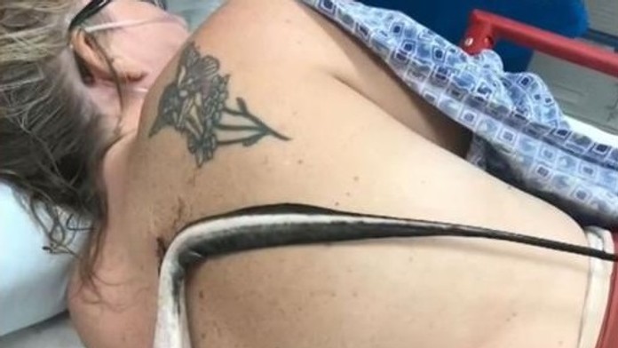 O vlások unikla smrti. Ženu pri plávaní napadla raja, bodnutie tesne minulo pľúca