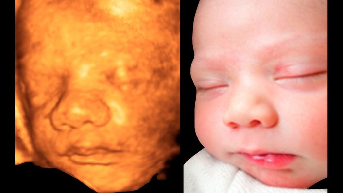 ilustračná snímka