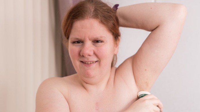 Kelly Fidoe-White trpí vzácnou metabolickou poruchou.