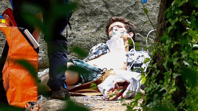 Mladík šliapol v newyorskom Central parku na výbušninu, explózia mu takmer utrhla nohu.