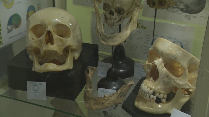 Naše telo dokáže pomáhať aj po smrti. Darovať ho na vedecké účely u nás nie je bežné