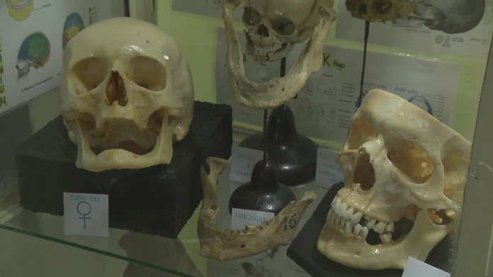 Naše telo dokáže pomáhať aj po smrti. Darovať ho na vedecké účely u nás nie je bežné