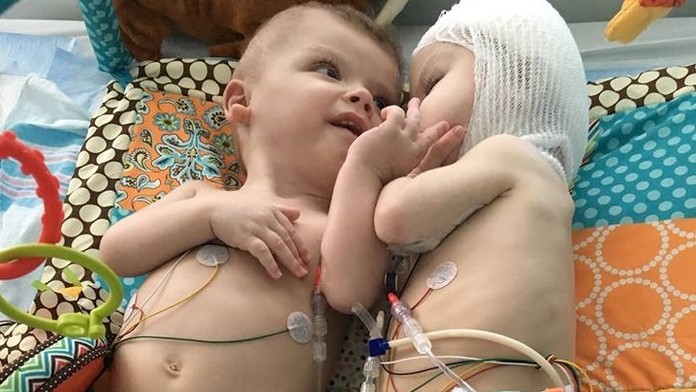 Video dvojičiek dojalo množstvo ľudí na internete.