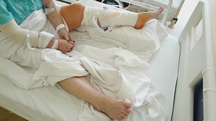 Zranená žena po útoku psom.