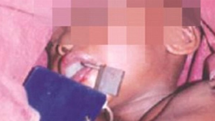 Ohavné. Otec dal synovi na ústa zámok, aby nemohol zavolať pomoc