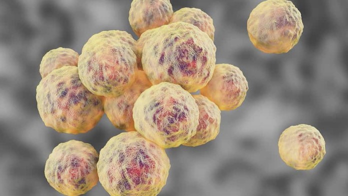 19 LV Zlaty stafylokok.transfer_tvnoviny.mp4