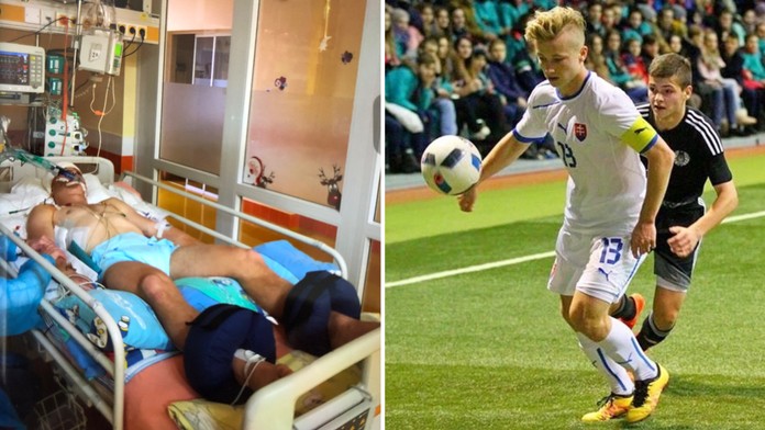 Prišiel o otca i polovicu lebky, dnes hlavou opäť dáva góly. Slovák z titánu v Anglicku „trpel“ svetové hviezdy