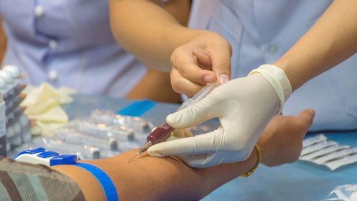 Odber krvi bez stresu: Tipy od odborníkov, ako zvládnuť strach z ihly