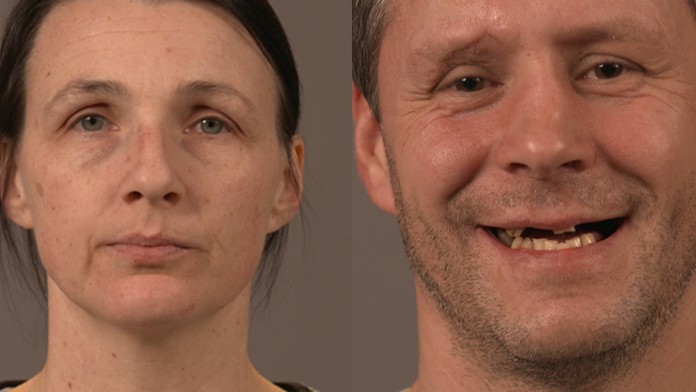 O 10 rokov mladší začína: Maroša a Máriu čaká úžasná zmena vizáže