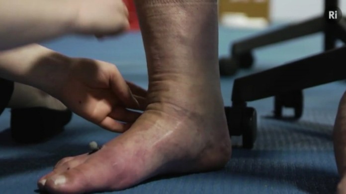 19 Zriedkave choroby (R).transferweb_jpg_bez_watermarku_1.jpg