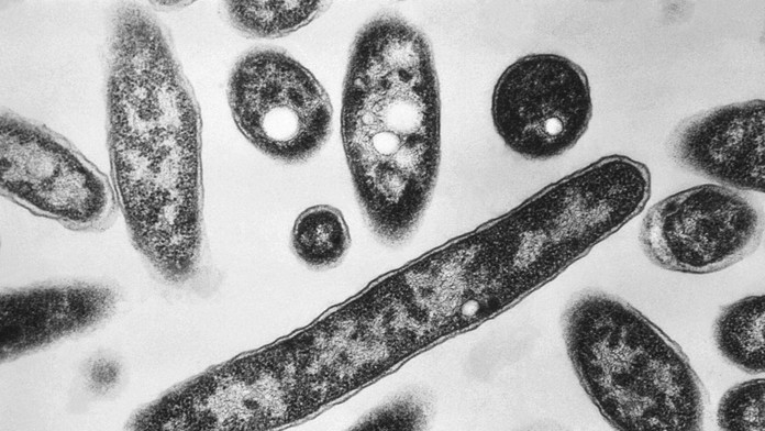 Legionella má v Poľsku už 22 obetí. Pôvod nákazy je stále záhadou
