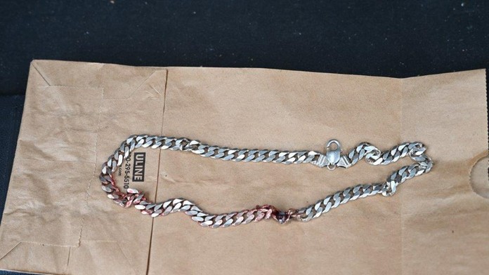 Život mu zachránila retiazka. Vystrelená guľka by inak skončila v jeho krku