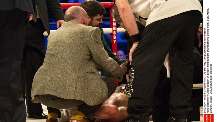 Nick Blackwell je v umelom spánku po sobotňajšom súboji s Chrisom Eubankom.