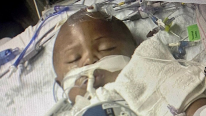 Legend bojuje po zásahu do hlavy o život