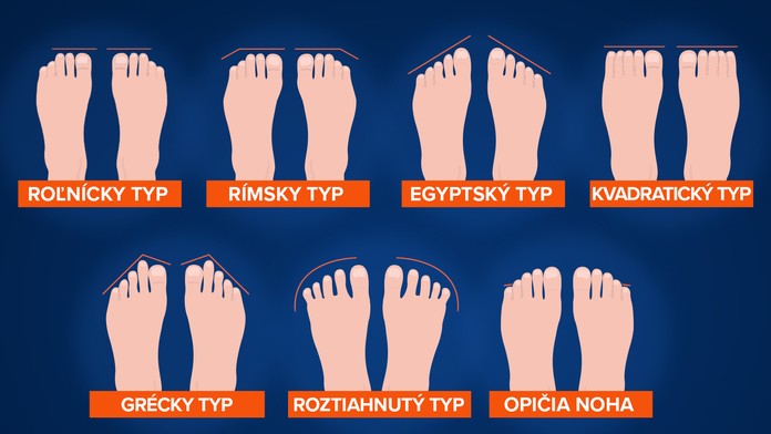 Typy chodidiel.