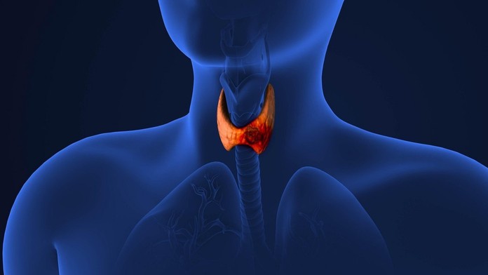 Príčinou vzniku rakoviny hrdla je vo veľkej miere orálny sex (ilustračná snímka)