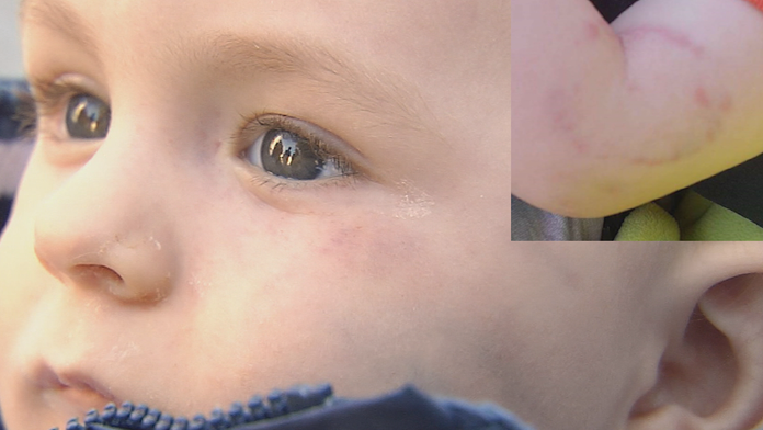 Dobitý a dohryzený Adamko