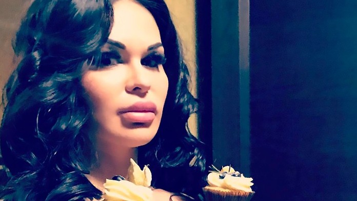 Má ich obrovské! Do pŕs si pichá kyselinu hyalurónovú, aby vyzerala prirodzene