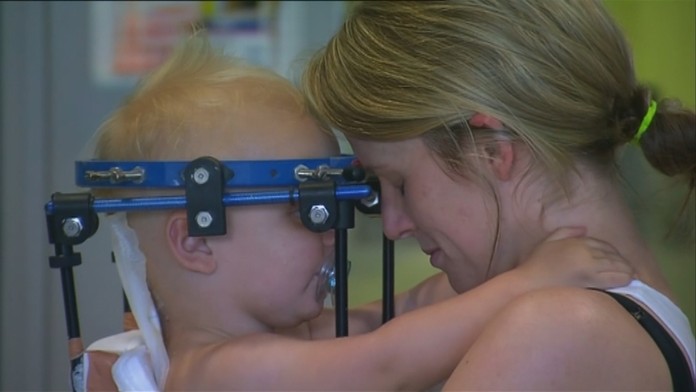 Lekári pripojili chlapčekovi hlavu naspäť k chrbtici