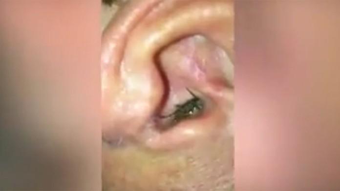 Muža bolelo ucho. Mobilom natočil, čo v ňom mal.