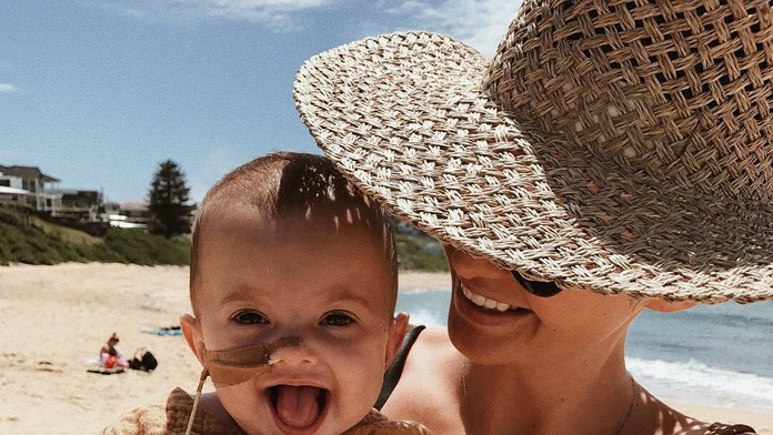 Rumi sa narodila s veľmi zriedkavou chorobou. 