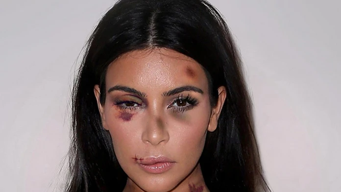 Kim Kardashian ako týraná žena.