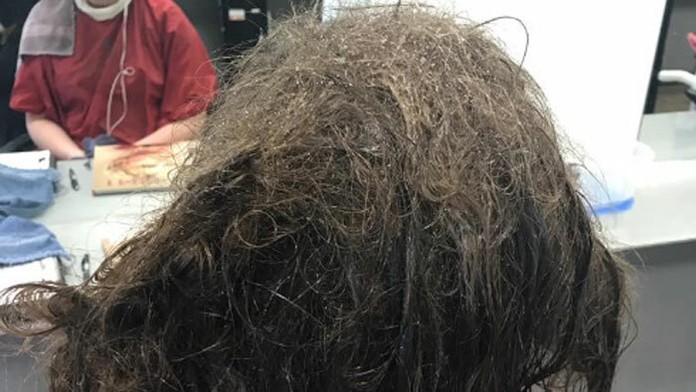 Dievča (16) malo vlasy v otrasnom stave. Kaderníčke sa podaril zázrak