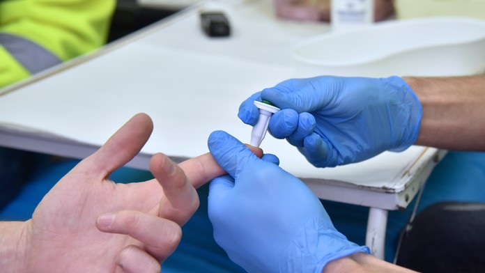 Verejnosť sa môže otestovať na vírusové ochorenia v 11 slovenských mestách