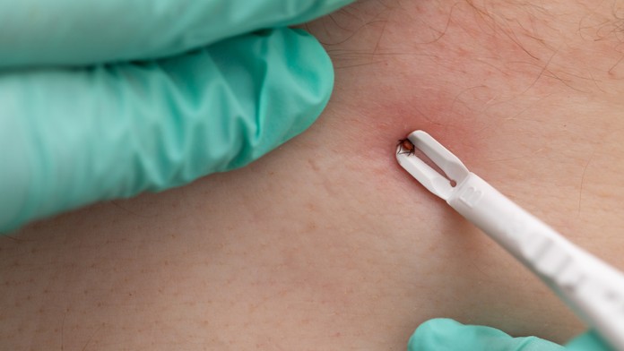 Na Slovensku tento rok evidujú vyše 180 prípadov kliešťovej encefalitídy. Riziko nepodceňujte ani na jeseň