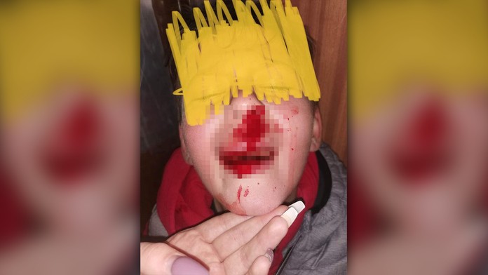 Osemročného chlapca zrazilo v Žiline auto, vodič nepomohol a odišiel. Mama aj polícia žiadajú o pomoc