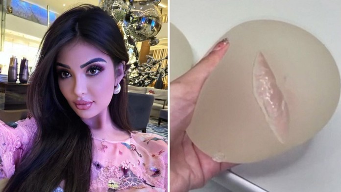 Podstúpila desiatky plastických operácií, teraz ich ľutuje