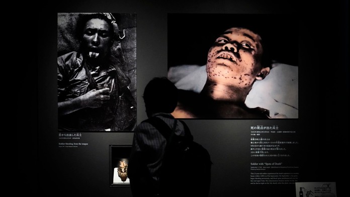 Fotografie zranených japonských vojakov v Múzeu mieru v Hirošime