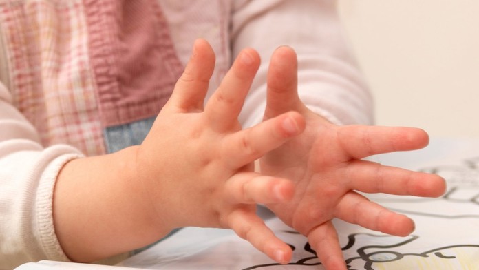 Len dvojročná Astrid prekonala tri mozgové mŕtvice. Spúšťačom boli zrejme ovčie kiahne