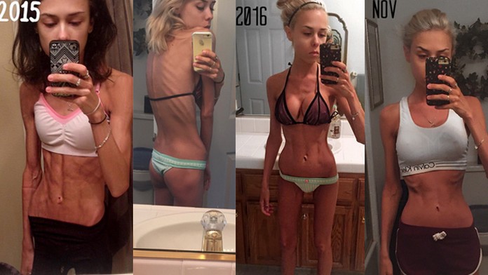 Bola na hranici so smrťou. Dnes vyzerá neskutočne sexy