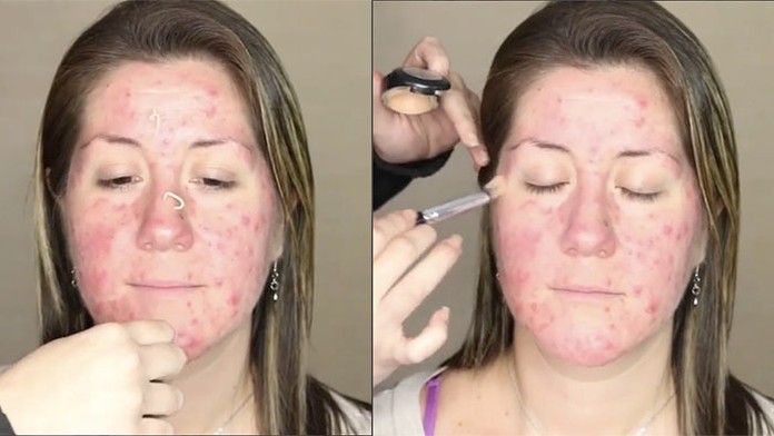 Vďaka vizážistke má na chvíľu krásnu pleť.