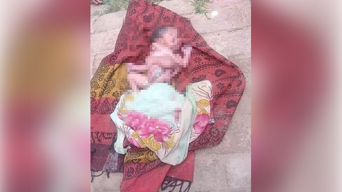 Indka porodila dieťa s ôsmimi končatinami a dvomi tvárami. Reakcia otca mnohých prekvapí