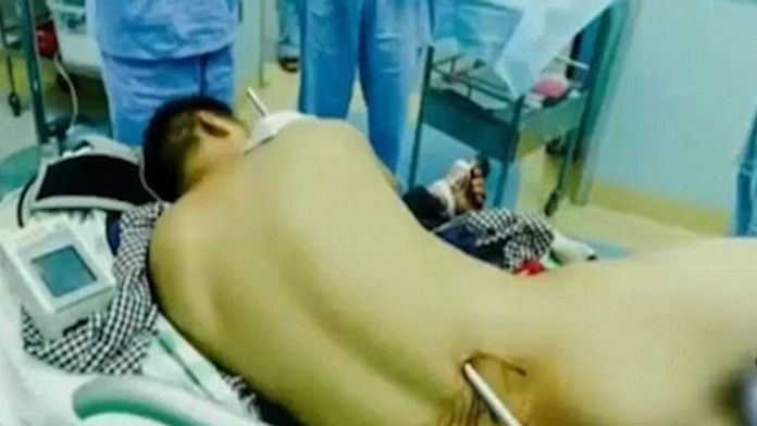 Tyč ho prerazila ako ražeň.