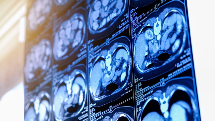 Ilustračná snímka 