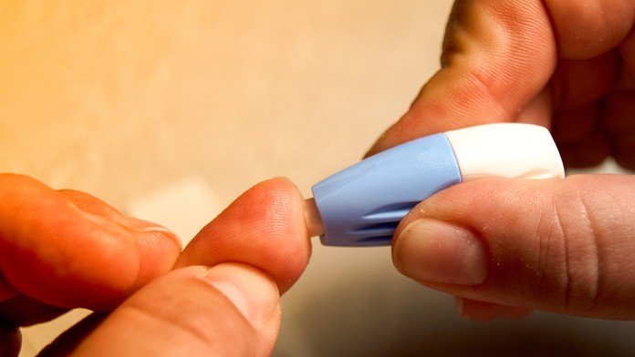 Test na HIV - ilustračná snímka.